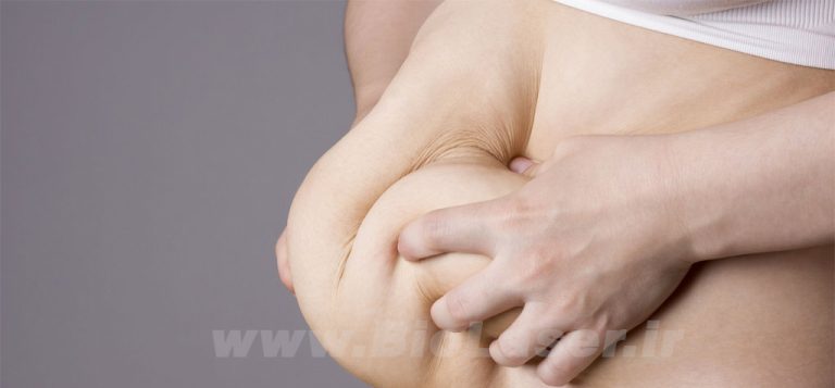 body-contouring-biolaser.ir